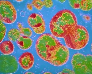 casogonorreiapior-300x242.jpg